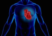 الوقاية من مرض قصور القلب