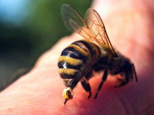 لدغات النحل