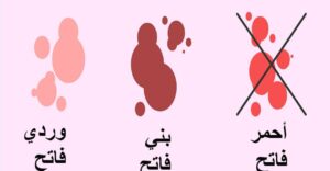 متى ينزل دم الحمل بالتفصيل وما هي أسبابه وأعراضه نادي العرب