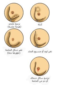 متى يبدأ ألم الثدي في الحمل ومتى ينتهي نادي العرب
