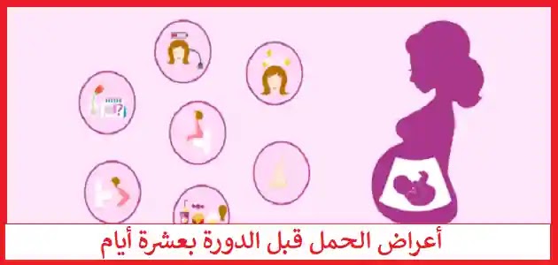 معقد هوية فاتنة من علامات الحمل Thibaupsy Fr