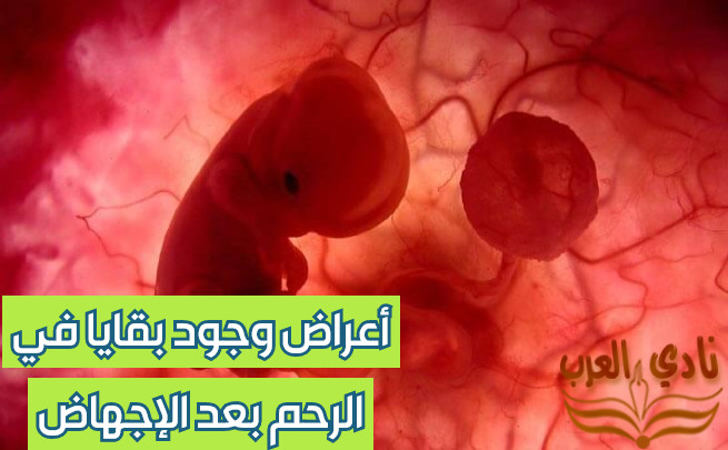 أعراض وجود بقايا في الرحم بعد الإجهاض