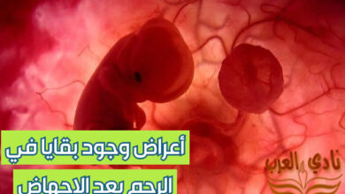 أعراض وجود بقايا في الرحم بعد الإجهاض