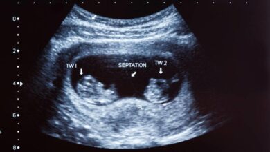 أعراض الولادة المبكرة في الشهر السادس